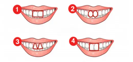 What Shape do Your Teeth Have Find Out What it Reveals About Your Personality
